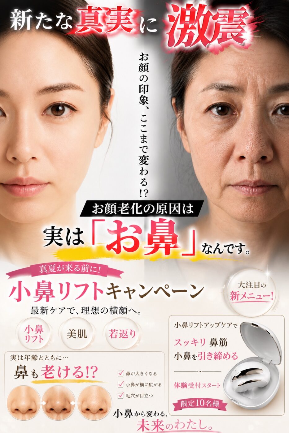 最新の小鼻リフト