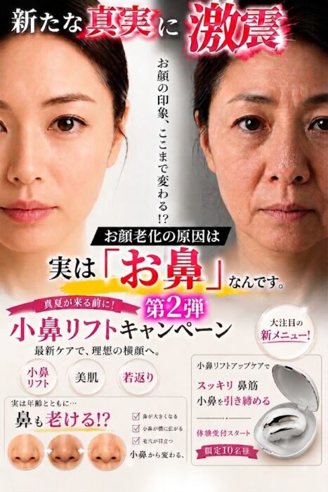 小鼻リフト 第2弾
